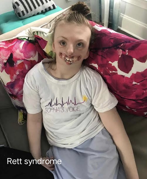 Understanding Rett Syndrome: Symptoms, Causes, and Treatments